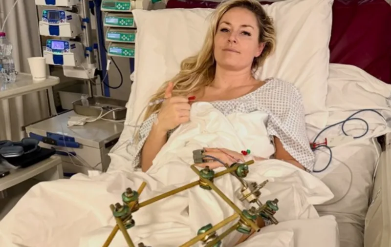 Lindey vonn