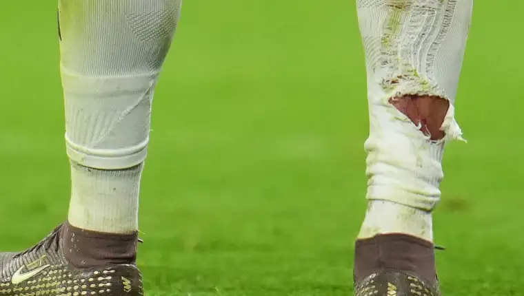 Mbappe