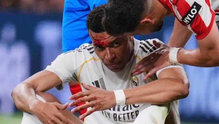 Mbappe 123