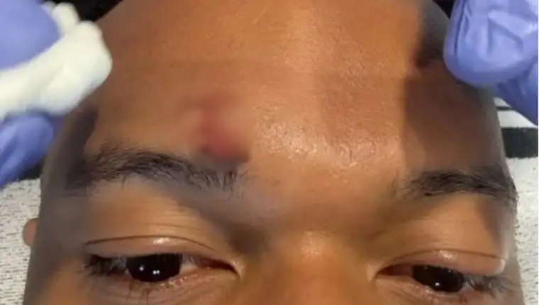 Mbappe 21