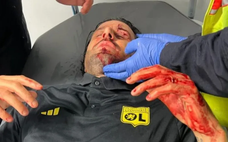 Fabio grosso 1